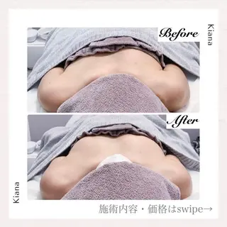 バスト専門Kiana 風のエステ・リラクイメージ