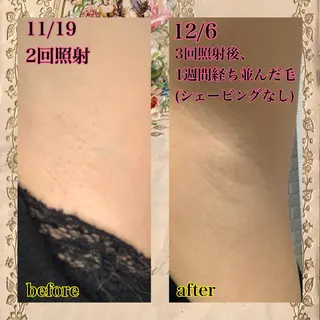 メンズ キッズ 脱毛サロン NR エヌアール所属・NR Nara yukiのエステ・リラクイメージ