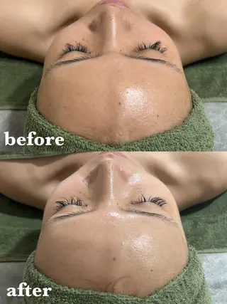 【肌質改善サロン】 リーフィアのエステ・リラクイメージ