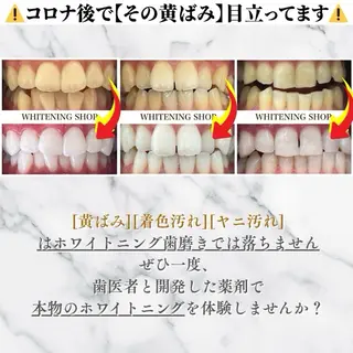 メンズ ホワイトニング ショップくずは店のエステ・リラクイメージ