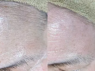 Facial Salon LUIRE所属・LUIRE　 ルイールのエステ・リラクイメージ