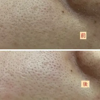 たるみ改善小顔エステ 堀葉月のその他イメージ