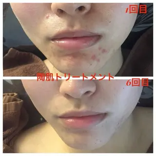 毛穴ニキビ専門 ビューティーグランツのエステ・リラクイメージ