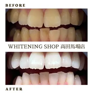 メンズ ホワイトニング ショップ高田馬場店のその他イメージ