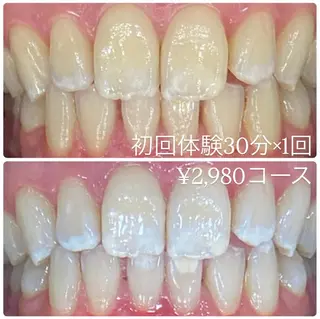 PLATINUM Beauty 横浜店所属・ホワイトニングルーム 横浜店のその他イメージ