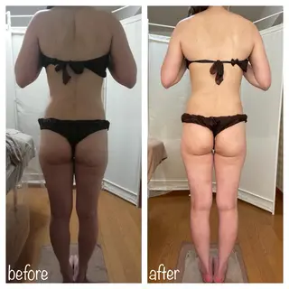 biloop所属・《痩身×疲労改善》 BILOOPのエステ・リラクイメージ