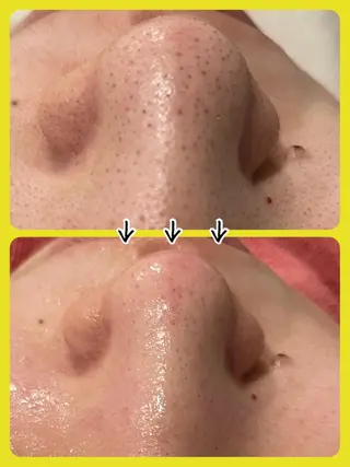 Dione八王子店所属・LUKE （ルーク）のエステ・リラクイメージ