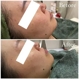 ハーブピーリング専門 muro.のエステ・リラクイメージ