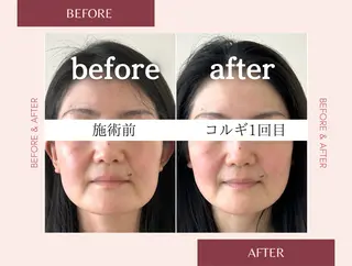 小顔コルギSalon de ETULEのエステ・リラクイメージ