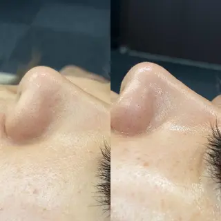 mavie（メヴィ）所属・毛穴洗浄肌管理サロン mavieのエステ・リラクイメージ