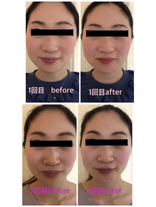 Nami Skinnieのエステ・リラクイメージ