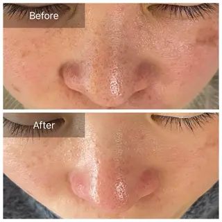 毛穴が見えなくなるサロン  Horo所属・岡 えり子のエステ・リラクイメージ