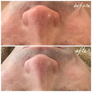 メンズ メナード岐阜茜部 杉浦のエステ・リラクイメージ