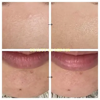 ビューティー ミロワールのエステ・リラクイメージ