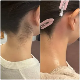 HUG🐰ワックス 脱毛 ホワイトニングのエステ・リラクイメージ