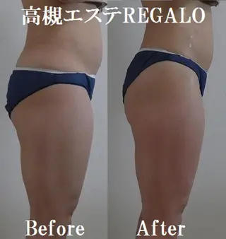 REGALO所属・矢野 さやかのエステ・リラクイメージ