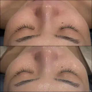 LiZA エステティックサロンのエステ・リラクイメージ