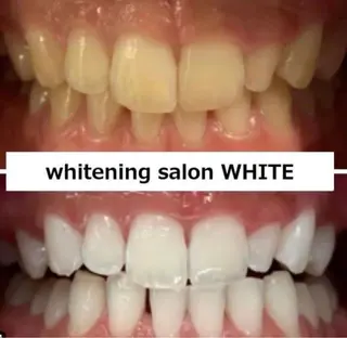 whitening salon WHITE 広島店所属・セルフホワイトニング 専門店WHITE広島のその他イメージ