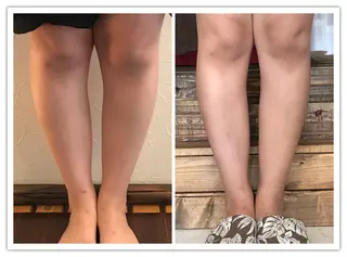 【足圧】鬼👹リンパ 身体整うサロンのエステ・リラクイメージ