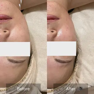 未病ケアサロン EMINY所属・未病ケアサロン EMINY☺︎勝俣のエステ・リラクイメージ