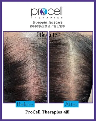 メンズ the 別嬪 静岡店所属・the 別嬪 静岡店のエステ・リラクイメージ