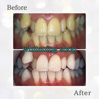 ホワイトニングショップ伊丹店所属・ホワイトニング ショップ伊丹店のその他イメージ