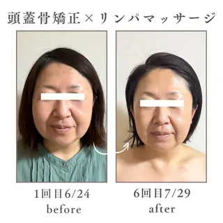 Mignon Lulu🎀のエステ・リラクイメージ