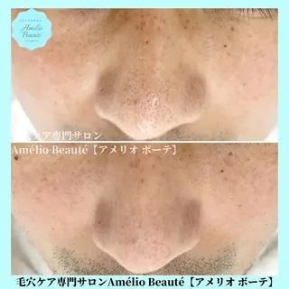 メンズ 毛穴ケア専門サロン Amélio Beauté所属・毛穴ケア専門サロン アメリオボーテのその他イメージ