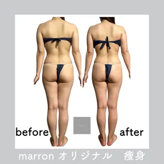 marron所属・痩身ハイパーナイフ ララピールリアボーテのエステ・リラクイメージ