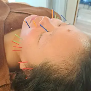 鍼灸サロンmiyabi所属・美容鍼×エステ　鍼灸 サロンmiyabiのエステ・リラクイメージ