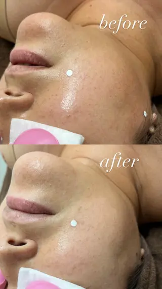 smileskin 御薗橋／meguのその他イメージ