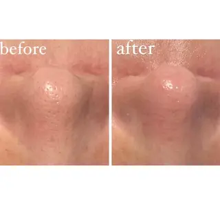 エムフルール リラク＆エステのエステ・リラクイメージ