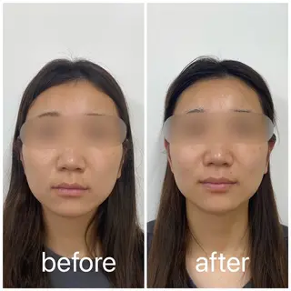 小顔矯正サロンLily所属・小顔矯正サロン Lilyのエステ・リラクイメージ