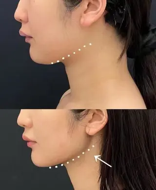 ショート aliaハイフ&水光ジェットサロン所属・aliaハーブ水光店 エステティシャン募集のエステ・リラクイメージ