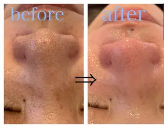 リジュベ所属・Rejuve ﾘｼﾞｭﾍﾞのエステ・リラクイメージ