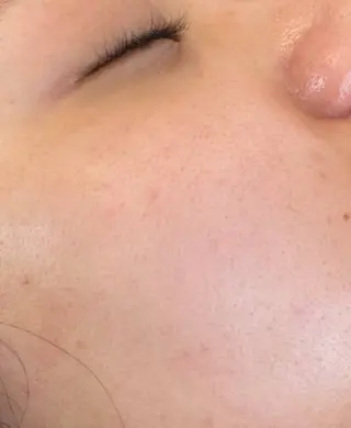 ADDICT中目黒店所属・毛穴洗浄/毛穴ケア 🌿中目黒🌿のエステ・リラクイメージ