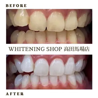 メンズ ホワイトニング ショップ高田馬場店のその他イメージ