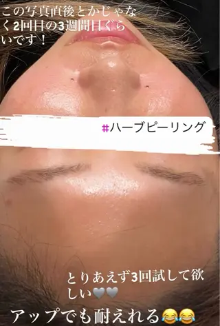 EstheticSalonReTweet所属・竹谷 春希のエステ・リラクイメージ