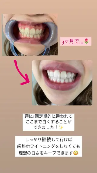 メンズ キッズ ネイル セルフホワイトニング エクシア沖縄宮里店のその他イメージ