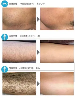 メンズ Beauty Salon Charmant所属・富山 千晶のエステ・リラクイメージ