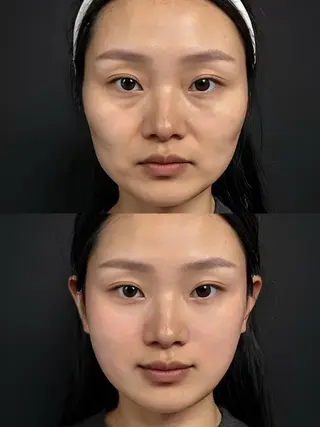 ネイル aliaハイフ&水光ジェットサロン所属・aliaハーブ水光店 エステティシャン募集のエステ・リラクイメージ