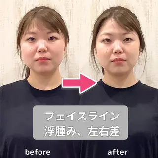 目黒/小顔/整体/ 理学療法士/萩谷太陽のエステ・リラクイメージ