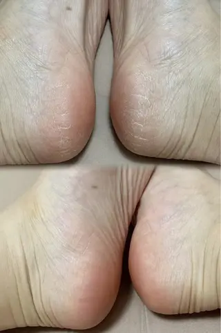 ネイル アヤメネイル 最新チップスカルプのネイルデザイン