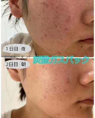 Fleur フルールのエステ・リラクイメージ