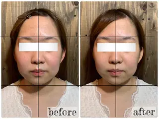 💎後悔させない小顔 矯正💎イトヤマ🌱のエステ・リラクイメージ