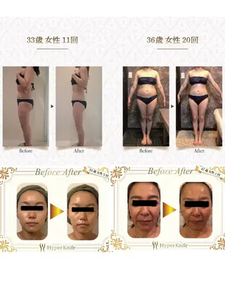 美癒 ハイパーナイフ&アロマ所属・美癒 池袋東口店のエステ・リラクイメージ