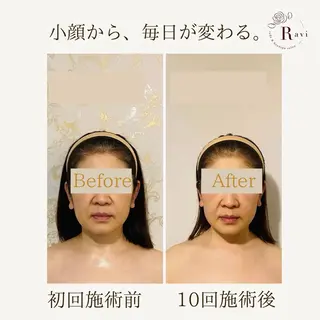 小顔サロンラヴィ　　船橋馬込沢店所属・小顔サロンラヴィ 船橋のエステ・リラクイメージ