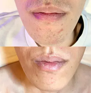 Lokahi所属・脱毛サロン Lokahiのエステ・リラクイメージ