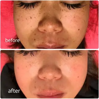 脱毛サロン　　　ベル・マタン所属・脱毛サロン ベル・マタンのエステ・リラクイメージ