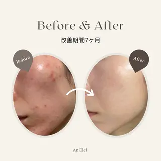 奥村 まよのエステ・リラクイメージ